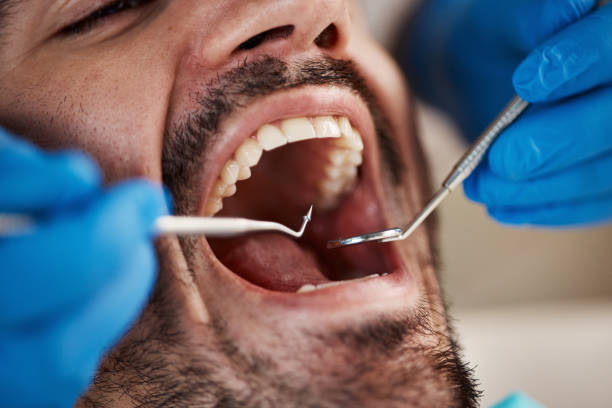 Best Emergency Dentist for Lost Fillings or Crowns in Rolling Fork, MS